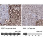 GRSF1 Antibody in Immunohistochemistry (IHC)