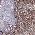 GRSF1 Antibody in Immunohistochemistry (IHC)