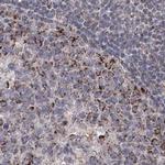 GRSF1 Antibody in Immunohistochemistry (IHC)