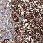 GRSF1 Antibody in Immunohistochemistry (Paraffin) (IHC (P))