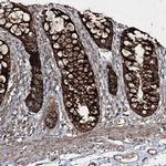 GRSF1 Antibody in Immunohistochemistry (Paraffin) (IHC (P))