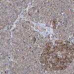 GRSF1 Antibody in Immunohistochemistry (Paraffin) (IHC (P))