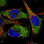 QARS Antibody in Immunocytochemistry (ICC/IF)