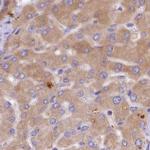 QARS Antibody in Immunohistochemistry (IHC)