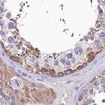 QARS Antibody in Immunohistochemistry (IHC)