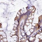 QARS Antibody in Immunohistochemistry (IHC)