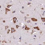 QARS Antibody in Immunohistochemistry (IHC)