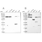 QARS Antibody in Western Blot (WB)