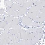 UBE1L2 Antibody in Immunohistochemistry (Paraffin) (IHC (P))