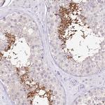 UBE1L2 Antibody in Immunohistochemistry (Paraffin) (IHC (P))