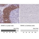 BANK1 Antibody in Immunohistochemistry (IHC)