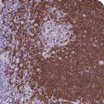 BANK1 Antibody in Immunohistochemistry (IHC)