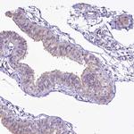 BANK1 Antibody in Immunohistochemistry (IHC)