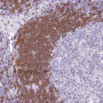 BANK1 Antibody in Immunohistochemistry (IHC)