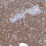 MAN2B2 Antibody in Immunohistochemistry (Paraffin) (IHC (P))