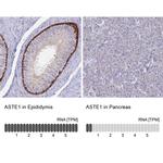 ASTE1 Antibody in Immunohistochemistry (IHC)