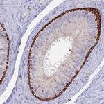 ASTE1 Antibody in Immunohistochemistry (IHC)