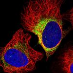 ASTE1 Antibody in Immunocytochemistry (ICC/IF)