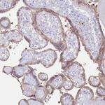 ASTE1 Antibody in Immunohistochemistry (Paraffin) (IHC (P))