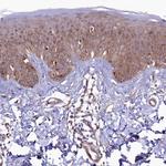 ASTE1 Antibody in Immunohistochemistry (Paraffin) (IHC (P))