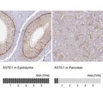 ASTE1 Antibody in Immunohistochemistry (IHC)