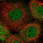 NCAPD2 Antibody in Immunocytochemistry (ICC/IF)