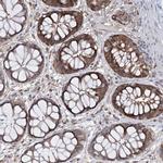 NCAPD2 Antibody in Immunohistochemistry (Paraffin) (IHC (P))