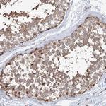 NCAPD2 Antibody in Immunohistochemistry (Paraffin) (IHC (P))