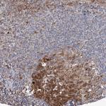 NCAPD2 Antibody in Immunohistochemistry (Paraffin) (IHC (P))