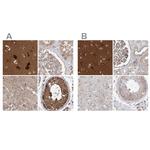 WDR37 Antibody in Immunohistochemistry (IHC)