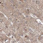 WDR37 Antibody in Immunohistochemistry (IHC)