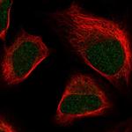 SKIV2L2 Antibody in Immunocytochemistry (ICC/IF)