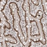 SKIV2L2 Antibody in Immunohistochemistry (IHC)