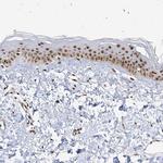 SKIV2L2 Antibody in Immunohistochemistry (IHC)