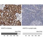 AGXT2 Antibody in Immunohistochemistry (IHC)