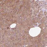 IQGAP2 Antibody in Immunohistochemistry (Paraffin) (IHC (P))