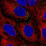 IQGAP2 Antibody in Immunocytochemistry (ICC/IF)