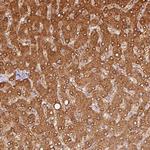 IQGAP2 Antibody in Immunohistochemistry (Paraffin) (IHC (P))