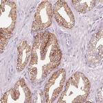 IQGAP2 Antibody in Immunohistochemistry (Paraffin) (IHC (P))