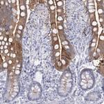 SLC6A19 Antibody in Immunohistochemistry (IHC)