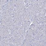 SLC6A19 Antibody in Immunohistochemistry (IHC)