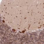 PCYOX1L Antibody in Immunohistochemistry (Paraffin) (IHC (P))