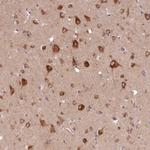 PCYOX1L Antibody in Immunohistochemistry (Paraffin) (IHC (P))