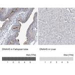 DNAH5 Antibody in Immunohistochemistry (IHC)