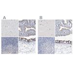 DNAH5 Antibody in Immunohistochemistry (IHC)