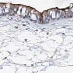 DNAH5 Antibody in Immunohistochemistry (IHC)