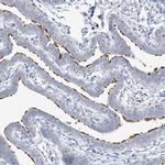 DNAH5 Antibody in Immunohistochemistry (IHC)