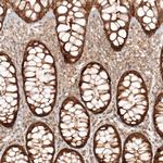 MICU1 Antibody in Immunohistochemistry (Paraffin) (IHC (P))