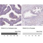 DNAH12 Antibody in Immunohistochemistry (IHC)