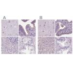 DNAH12 Antibody in Immunohistochemistry (IHC)